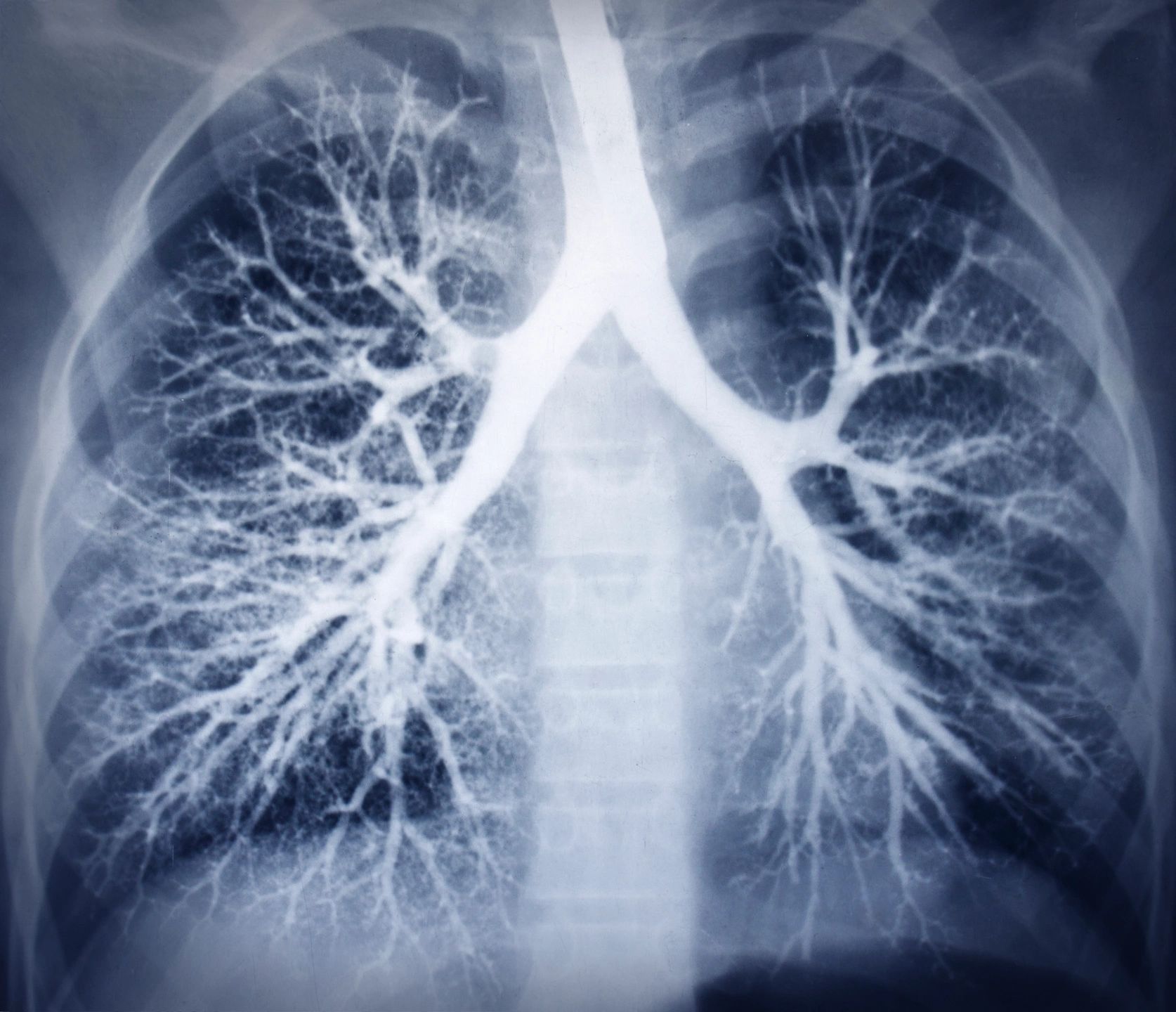 Pulmonology Clinical Trials